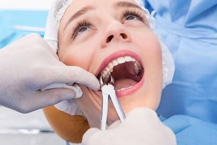 Răng số 5: Vai trò quan trọng và những điều bạn cần biết 4