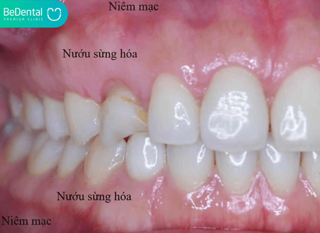 Duong Tiep Noi Nuou – Niem Mac