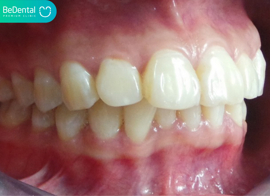 Giải phẫu răng: Cấu tạo và chức năng của từng bộ phận 5 Giải phẫu răng. Giải phẫu răng. Giải phẫu răng. Giải phẫu răng