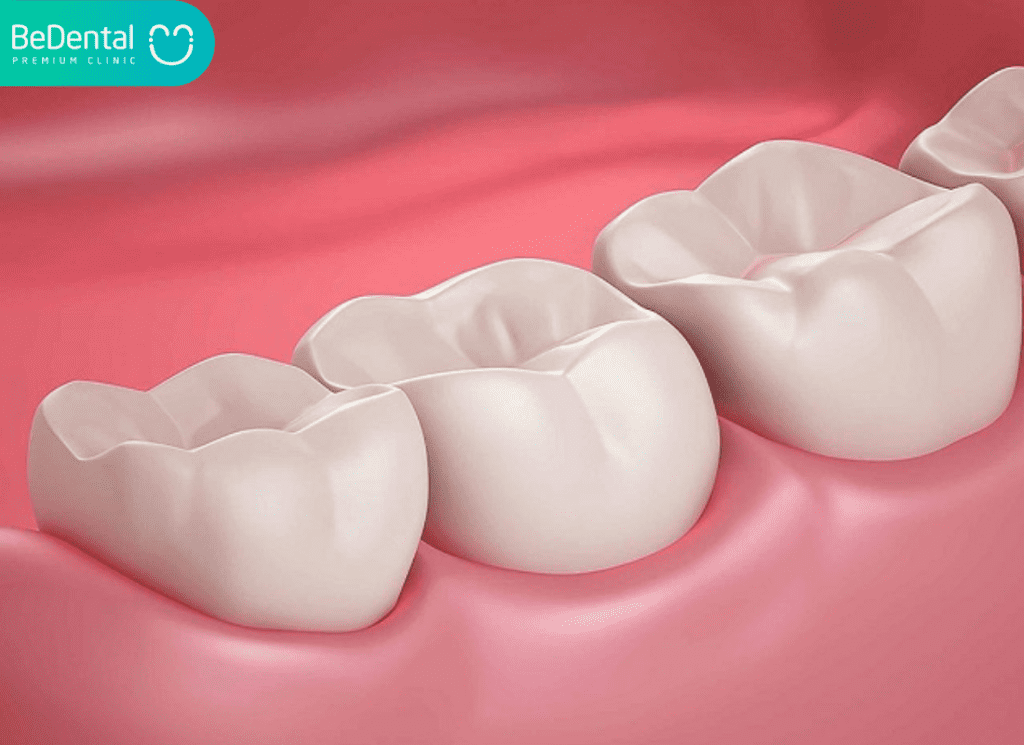 Cách Chữa Răng Hàm Bị Sâu Hiệu Quả: Từ Lỗ Sâu Răng Nhỏ Đến Viêm Tủy 2 cách chữa răng hàm bị sâu