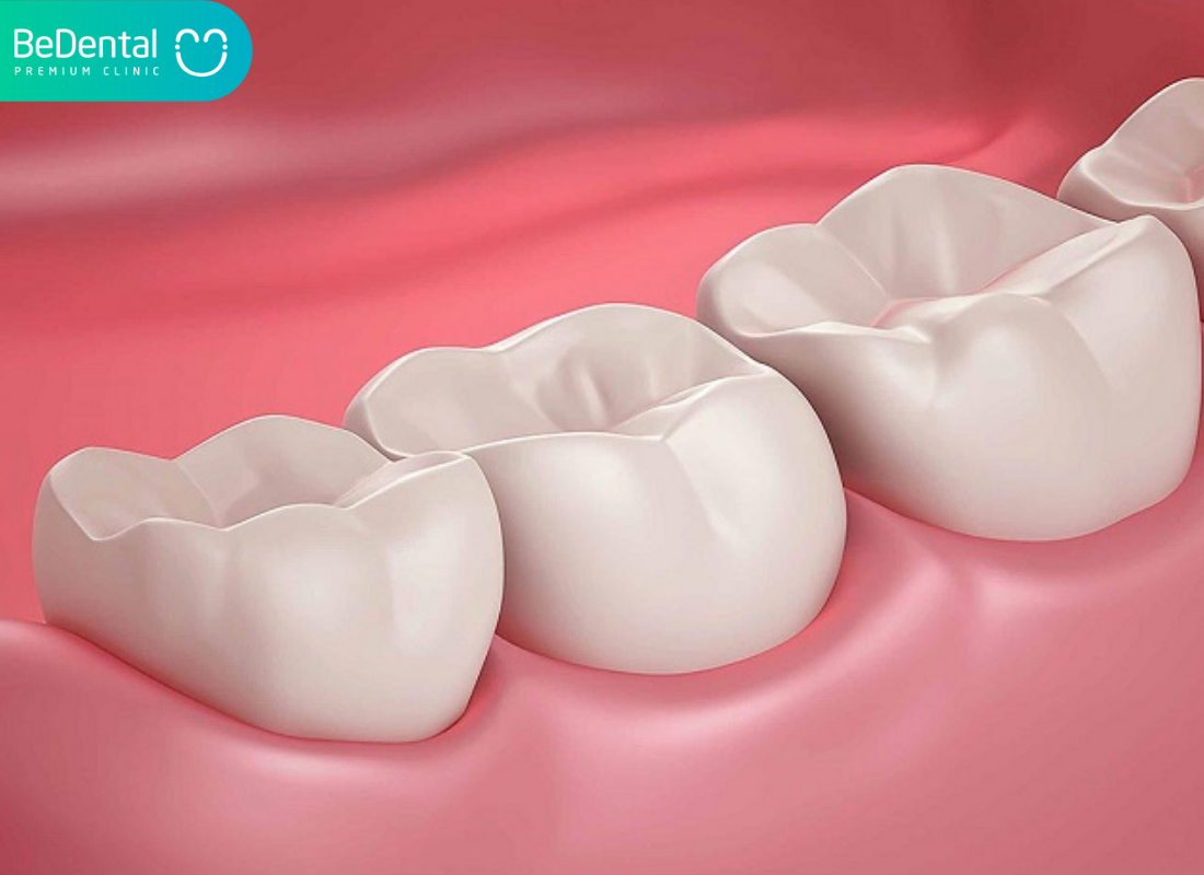 Cách Chữa Răng Hàm Bị Sâu Hiệu Quả: Từ Lỗ Sâu Răng Nhỏ Đến Viêm Tủy 8 cách chữa răng hàm bị sâu