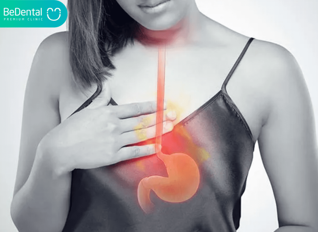 Đẹn Trăng: Nguyên Nhân, Dấu Hiệu Và Cách Trị Đẹn Lưỡi Hiệu Quả 3 Van De Trao Nguoc Da Day