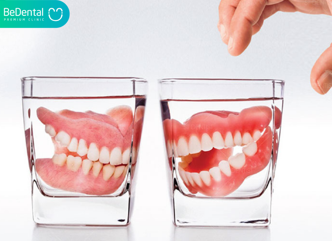 Nguyên nhân khiến trồng răng giả bị hôi