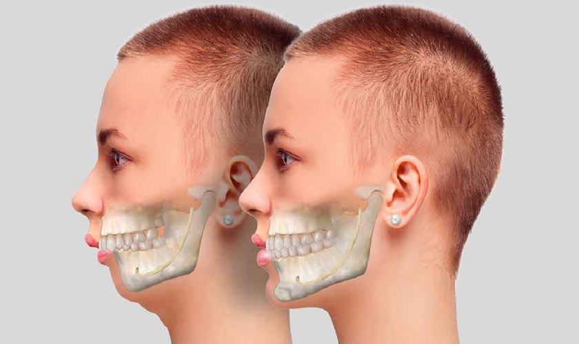 cach nhan biet rang ho