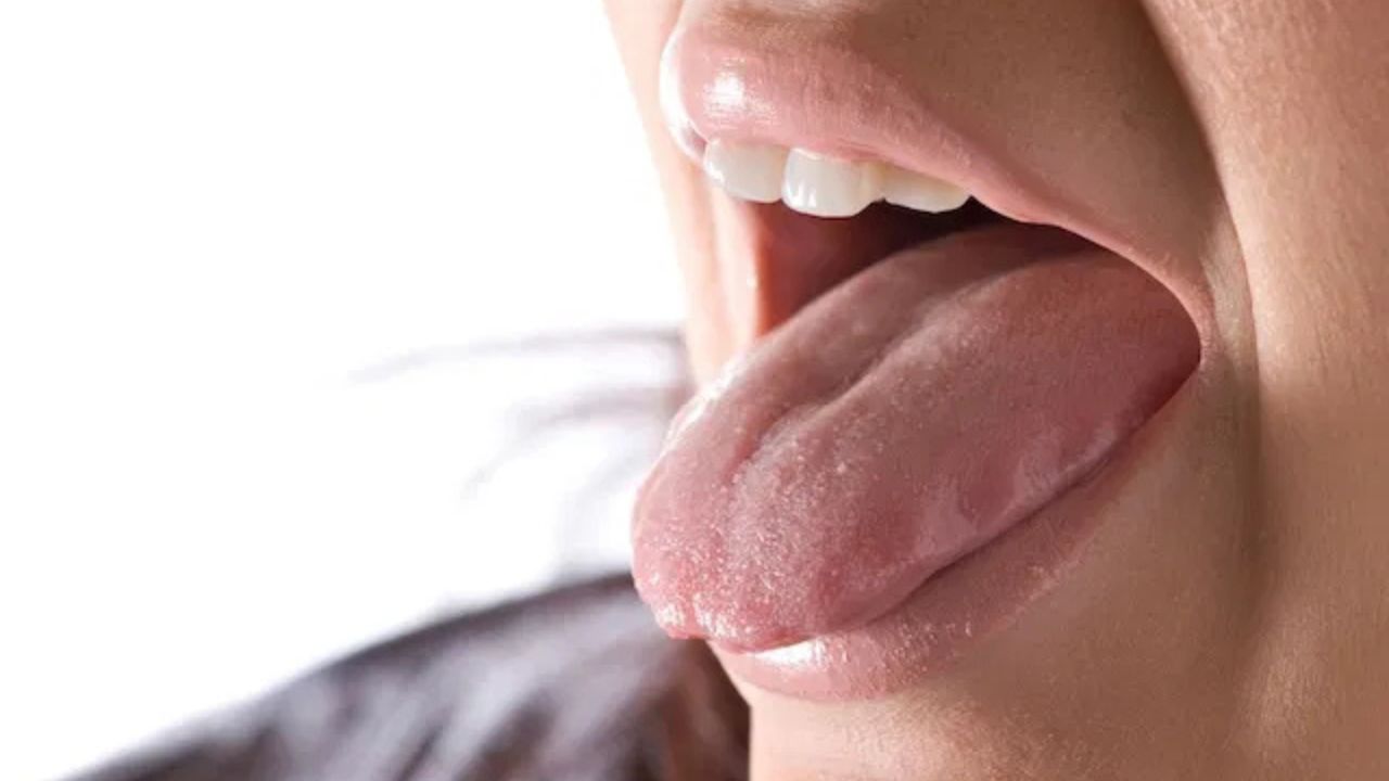 Bị đắng cổ họng: Nguyên nhân, dấu hiệu đi kèm và 3 cách khắc phục hiệu quả 4 co hong bi dang 3