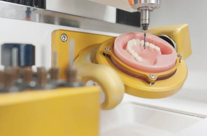 2 công nghệ trồng răng mới nhất: Giải pháp phục hình hiện đại, nhanh chóng và an toàn 5 cong nghe cad cam 1