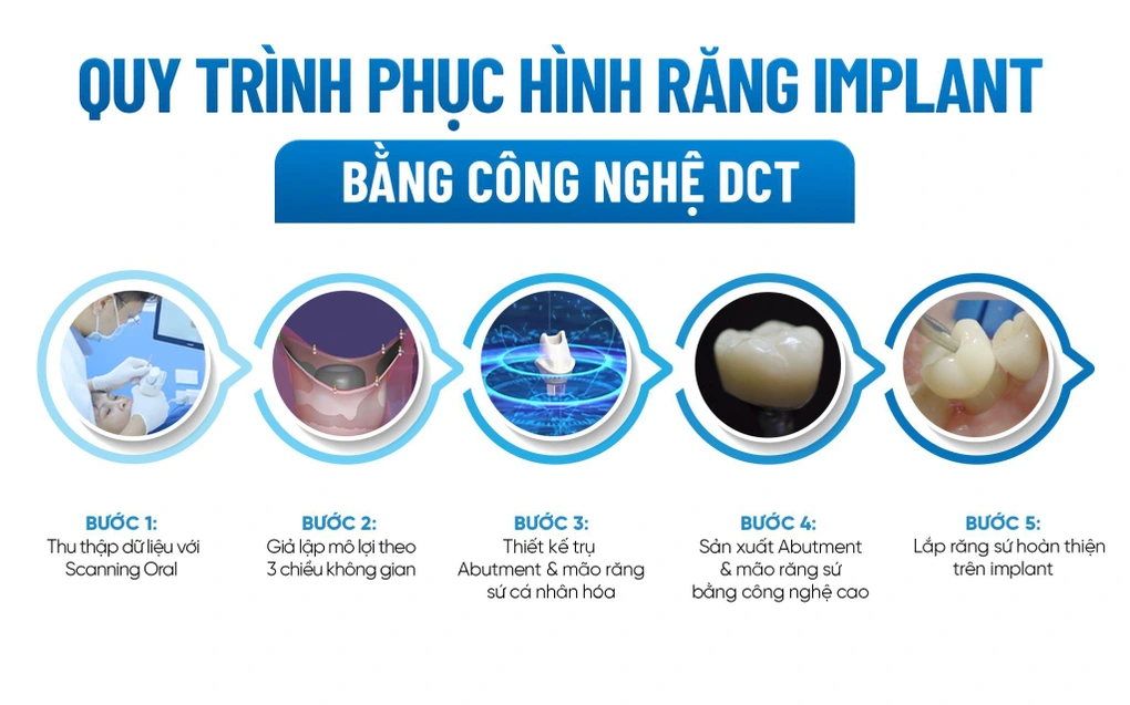 2 công nghệ trồng răng mới nhất: Giải pháp phục hình hiện đại, nhanh chóng và an toàn 3 cong nghedocx 1683742151509