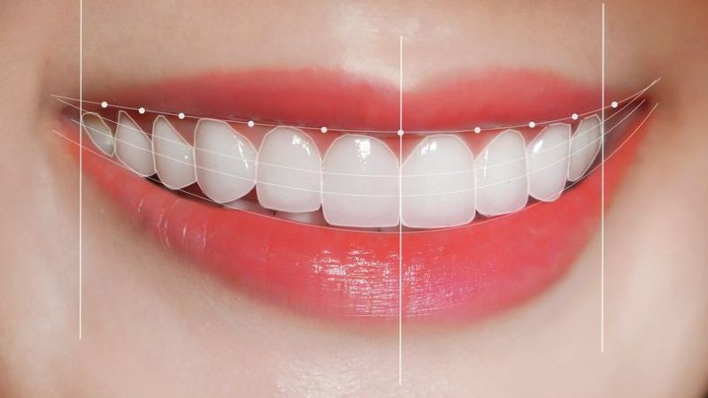 Cung răng là gì? Vai trò, cấu trúc và những vấn đề thường gặp 8 cung rang la gi dac diem cua cung rang va cach doc vi tri cac rang 202311200349055391