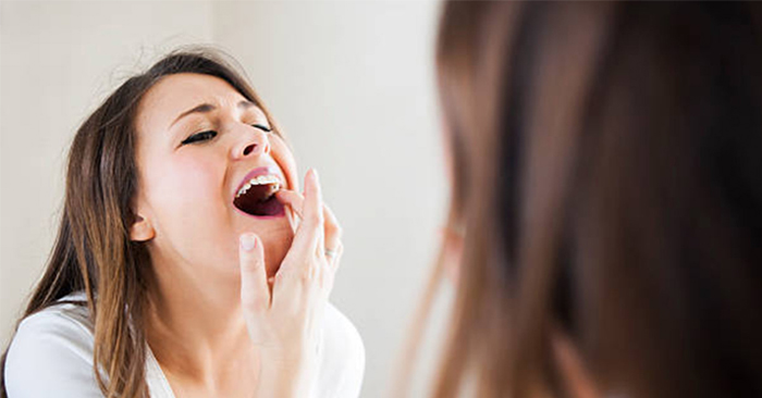Nhức chân răng hàm trên: Nguyên nhân, dấu hiệu và cách xử lý hiệu quả 8 Nhức chân răng hàm trên. Nhức chân răng hàm trên. Nhức chân răng hàm trên. Nhức chân răng hàm trên