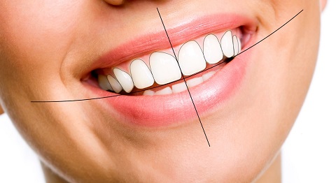 Cung răng là gì? Vai trò, cấu trúc và những vấn đề thường gặp 3 ham rang dep 1