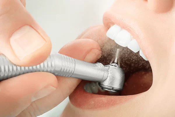 Máy đánh bóng răng cầm tay: Giải pháp làm sạch và làm trắng răng tại nhà có thực sự hiệu quả? 7 Máy đánh bóng răng cầm tay. Máy đánh bóng răng cầm tay. Máy đánh bóng răng cầm tay