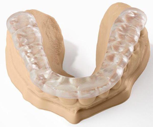 Dụng cụ bảo vệ răng là gì?