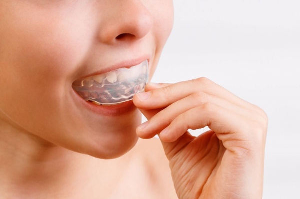 mang chong nghien rang