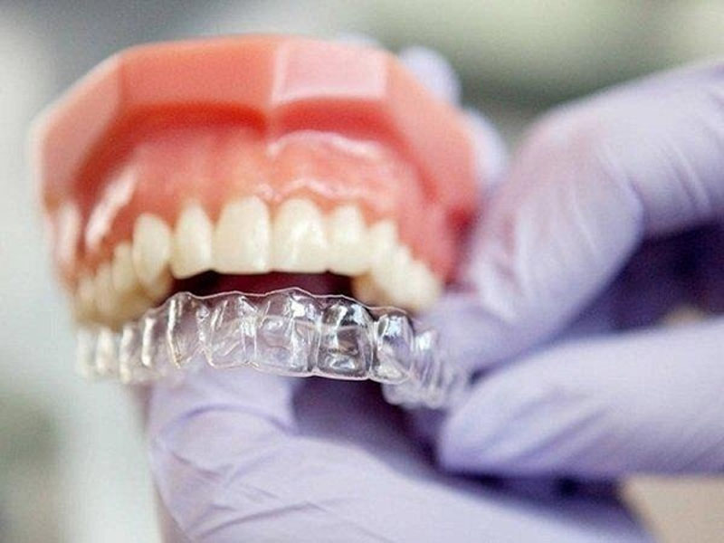 Sẽ móm là gì? Nguyên nhân, dấu hiệu và cách khắc phục hiệu quả 5 nieng rang trong suot