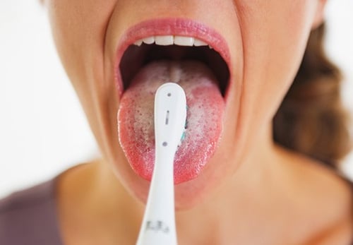 Lưỡi Có Đốm. Lưỡi Có Đốm. Lưỡi Có Đốm. Lưỡi Có Đốm