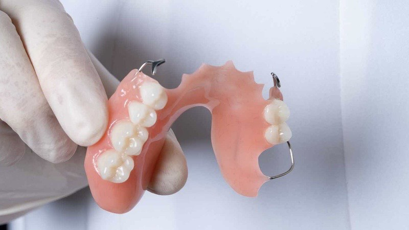 tim hieu ve ham khung thao lap kim loai va nhung dieu can luu y 3 cda5a288dc