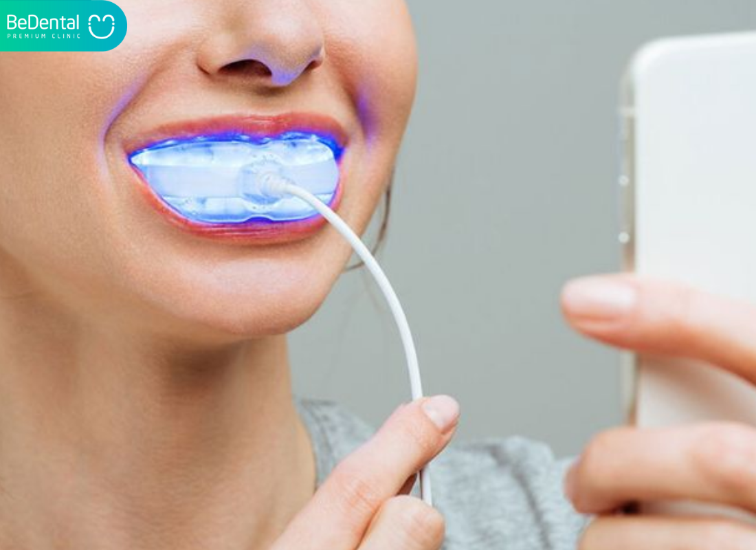 2 cách sử dụng dầu oliu làm trắng răng dễ áp dụng và hiệu quả nhất 7 Cach su dung may trang rang