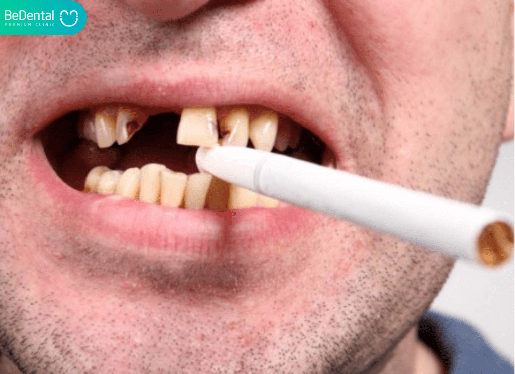 Giải Pháp Toàn Diện Cho Hơi Thở: Cách Khử Mùi Thuốc Lá Trong Miệng Hiệu Quả Và Lâu Dài 2 Cách Khử Mùi Thuốc Lá Trong Miệng