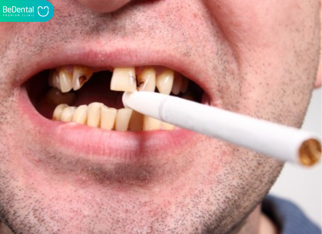 Co Che Gay Hoi Mieng Cua Thuoc La