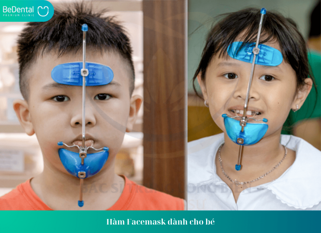 Khớp Cắn Ngược Ở Trẻ Nhỏ Là Gì? Phải Điều Trị Ra Sao? Chi Phi Thế Nào? 5 Ham Facemask danh cho be