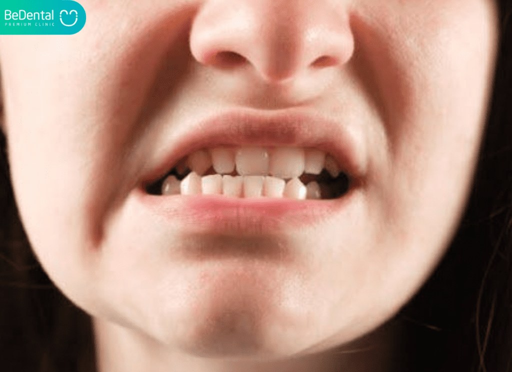 Hiện Tượng Khuôn Mặt Bị Lệch Khi Chụp Ảnh: Nguyên Nhân, Cơ Chế Ảo Ảnh Và Giải Pháp Cải Thiện Toàn Diện 4 Lech Do Cac Van De Ve Rang Va Khop Can