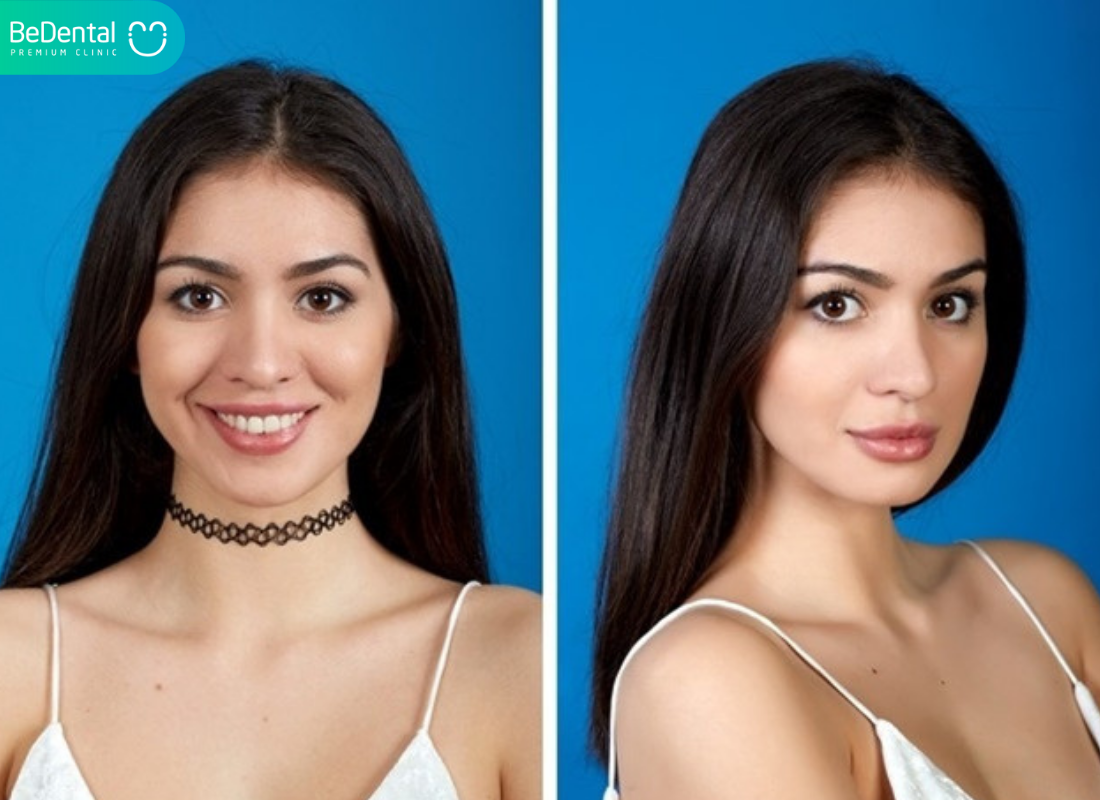 Su Khac Biet Giua Guong Va Camera