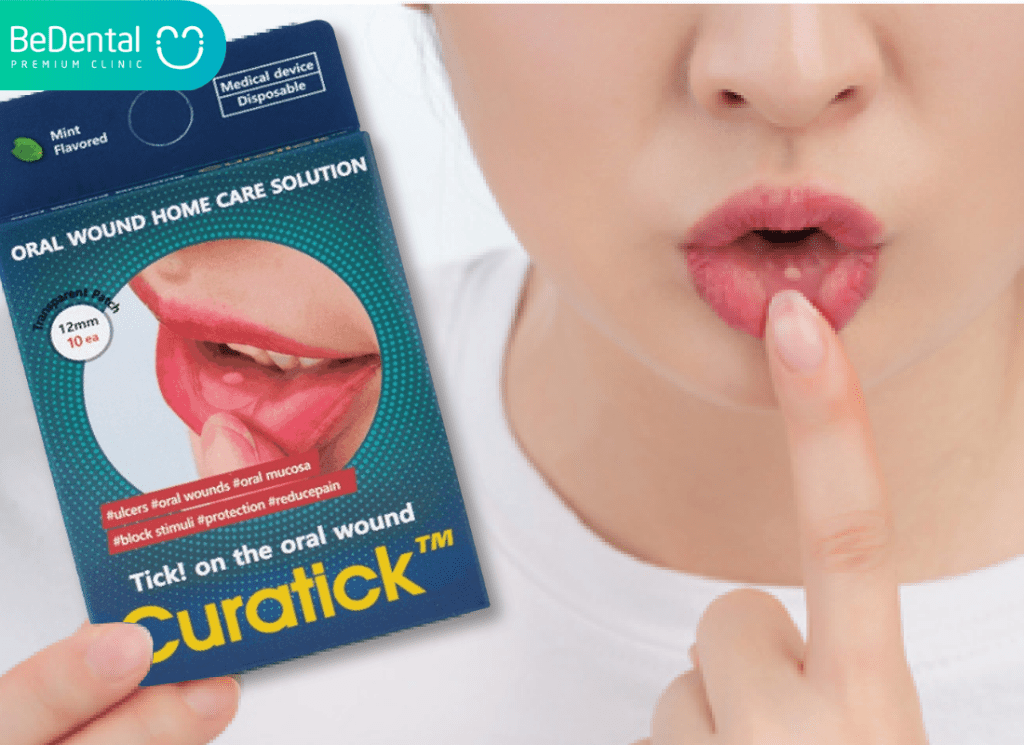 Mieng dan nhiet mieng Curatick