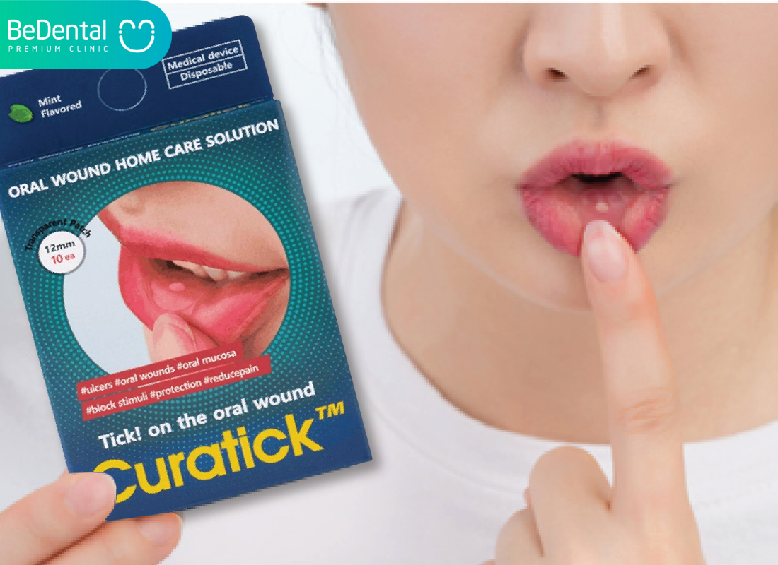 Mieng dan nhiet mieng Curatick