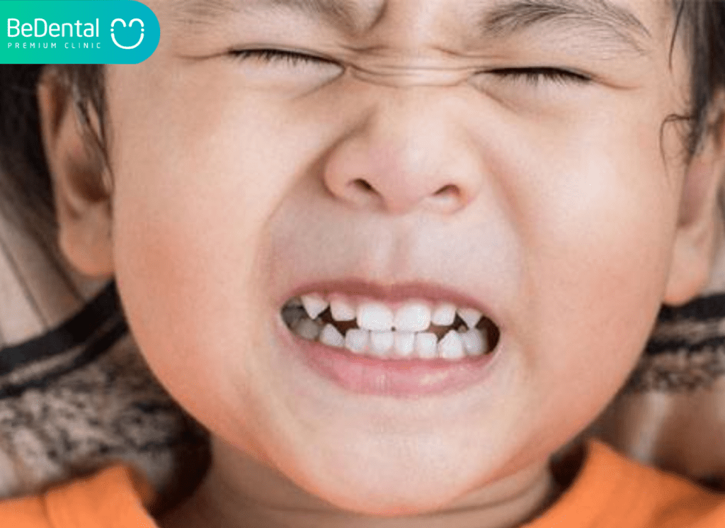 Tre nghien rang thieu chat gi 01