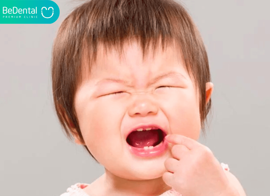 Trường hợp nanh sữa lành tính