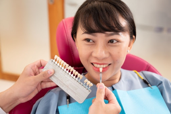 co the lua chon mau rang su