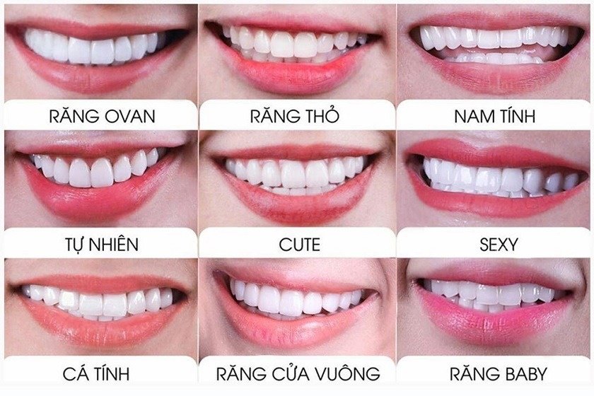 Chọn răng sứ phù hợp với khuôn mặt. Chọn răng sứ phù hợp với khuôn mặt