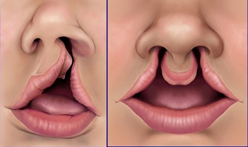 ho ham ech 2 17407285389991090796272