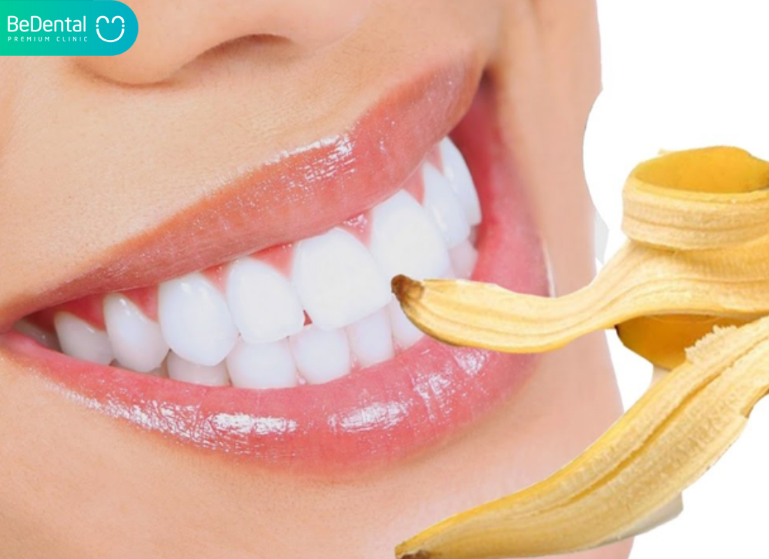 lay cao rang bang vo chuoi