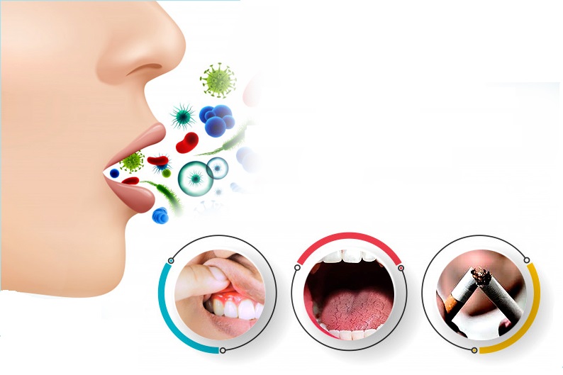 Cách trị chảy máu chân răng hôi miệng tại nhà. Cách trị chảy máu chân răng hôi miệng tại nhà