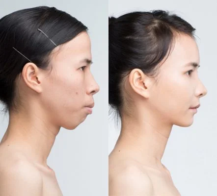 phau thuat ham ho bao nhieu tien 1 1 442x400 1