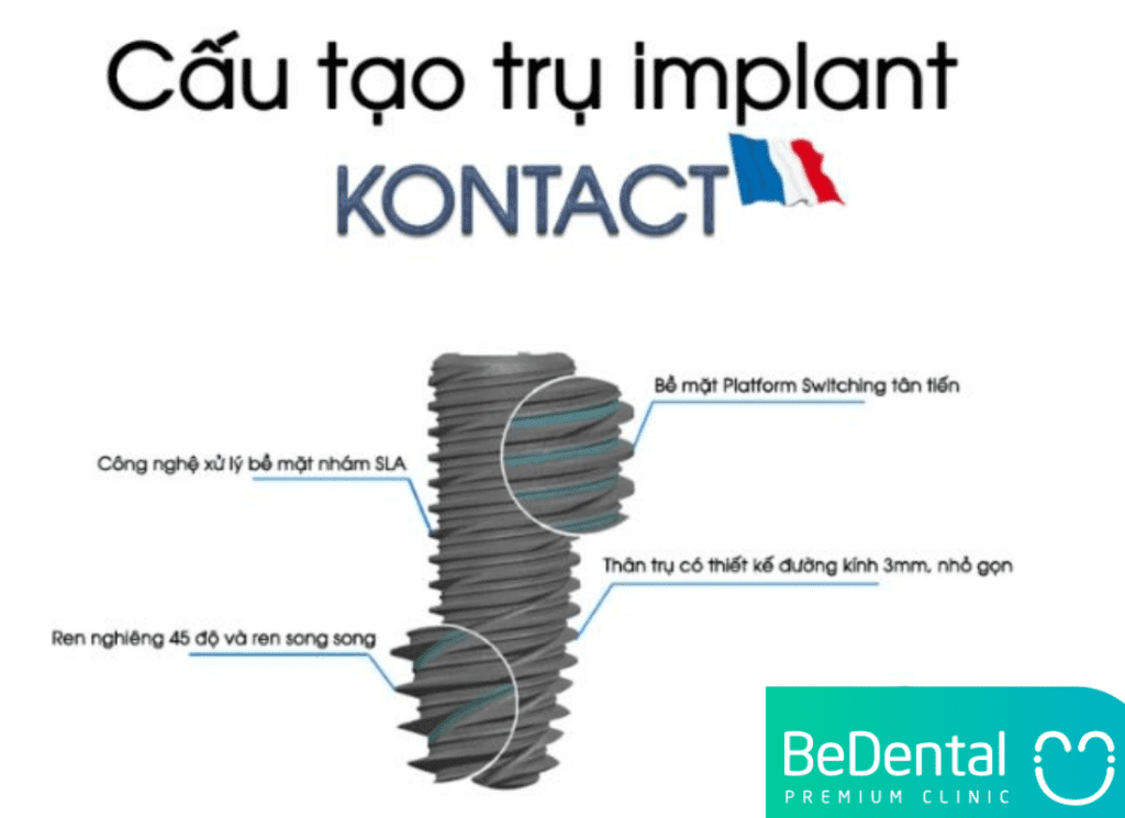 TRỤ IMPLANT KONTACT: XUẤT XỨ,CẤU TẠO VÀ GIÁ CẢ 3 Cau tao Tru Implant