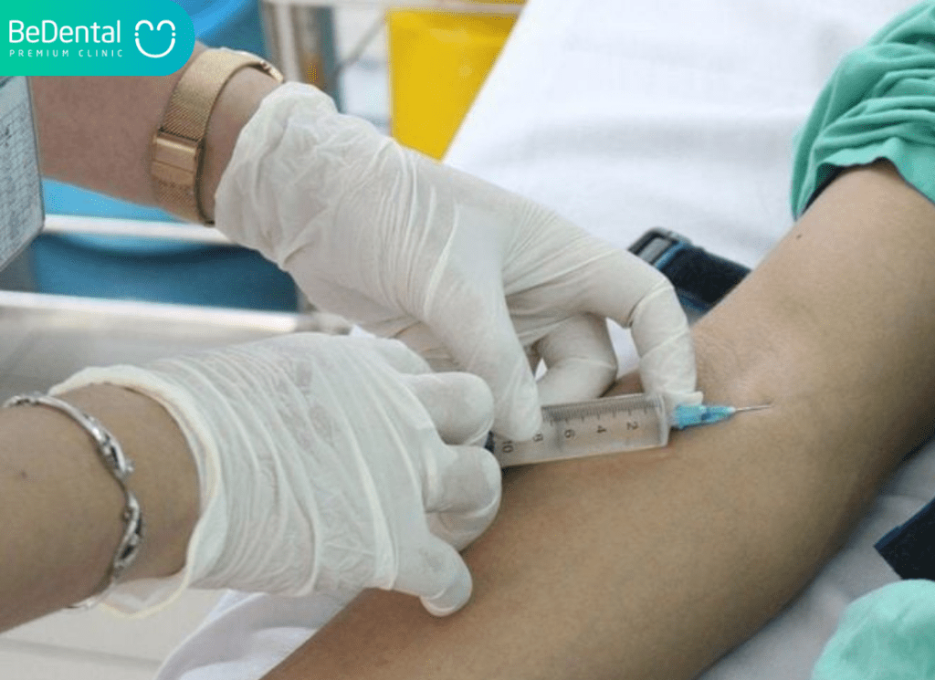 chi phí gây mê nhổ răng