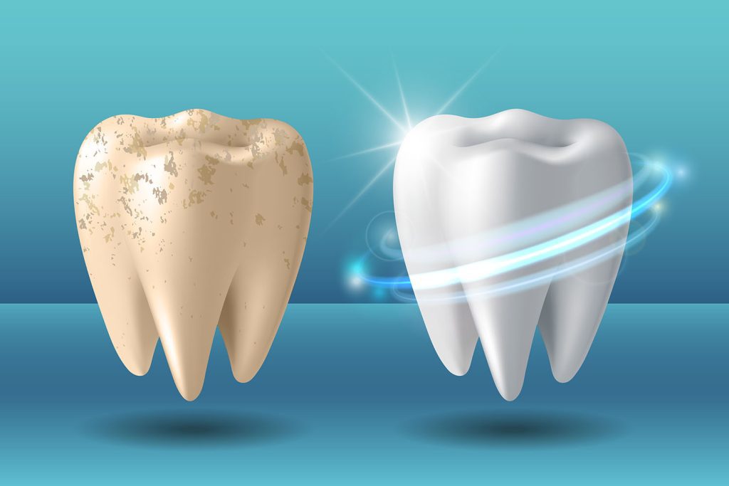teeth or tooth