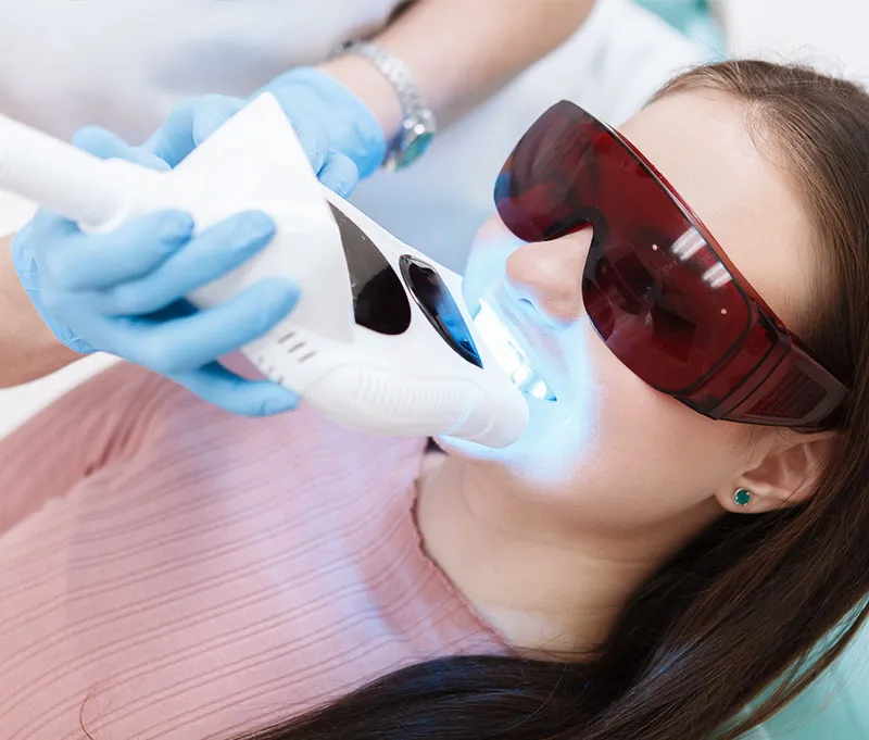 15+ Popular Treatments for Stained Teeth in Vietnam 8 7 1 1