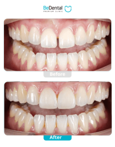 Customer Library 28 BA web.pdf 11