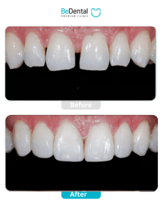 Customer Library 25 BA web.pdf 15