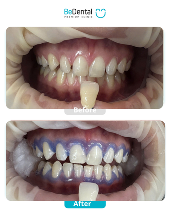 Thư viện khách hàng 15 BA web.pdf 8