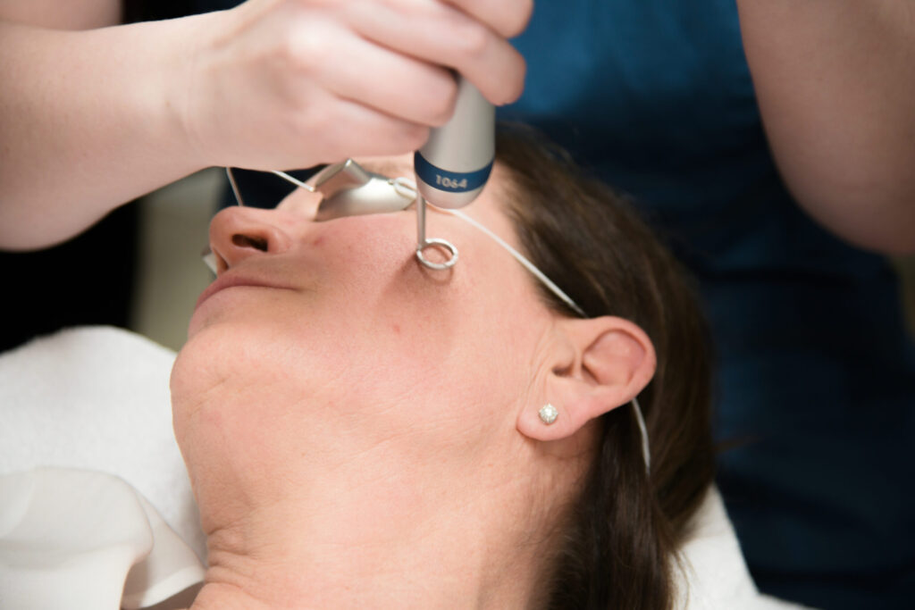 Birthmark Removal in Vietnam: Safe and Advanced Aesthetic Solutions 5 Birthmark Removal in Vietnam 3