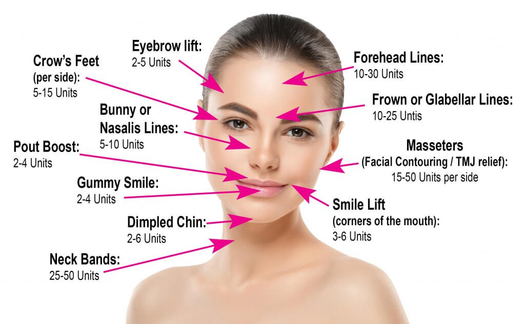 Botox Treatment in Vietnam: Reduce Wrinkles for a Youthful Appearance 3 Botox Treatment in Vietnam: Reduce Wrinkles for a Youthful Appearance
