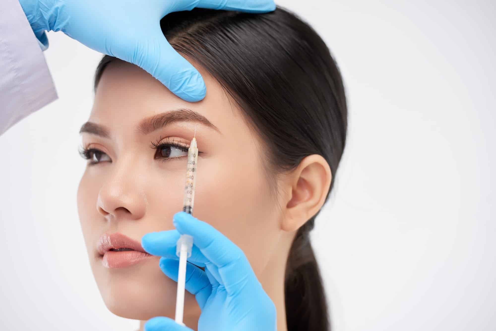 Brow Lift in Vietnam: Restore a Youthful and Refreshed Appearance 7 Brow Lift in Vietnam 5