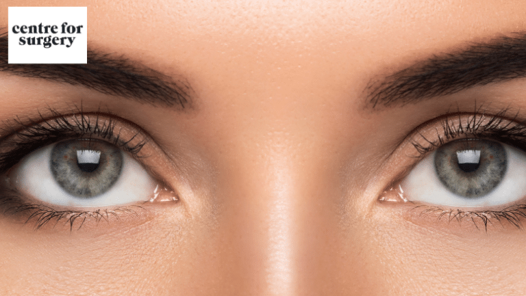 Canthoplasty in Vietnam: Reshape and Enhance Eye Definition 4 Canthoplasty in Vietnam 2