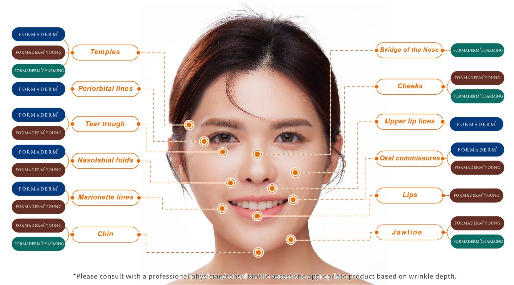 Dermal Filler Treatment in Vietnam 3
