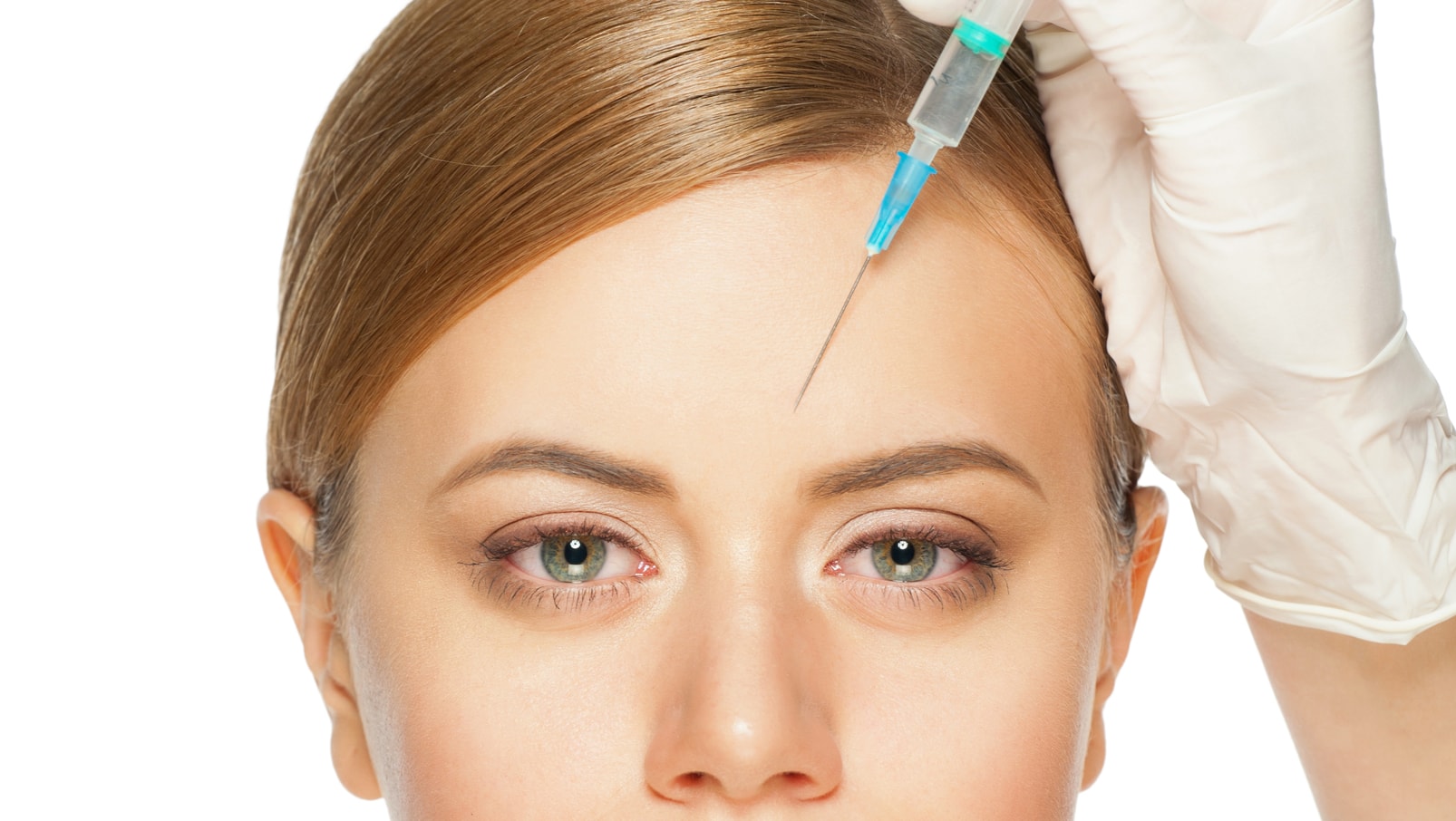 Forehead Lift Surgery in Vietnam – Smooth Wrinkles and Elevate Your Look 6 Forehead Lift Surgery in Vietnam 4