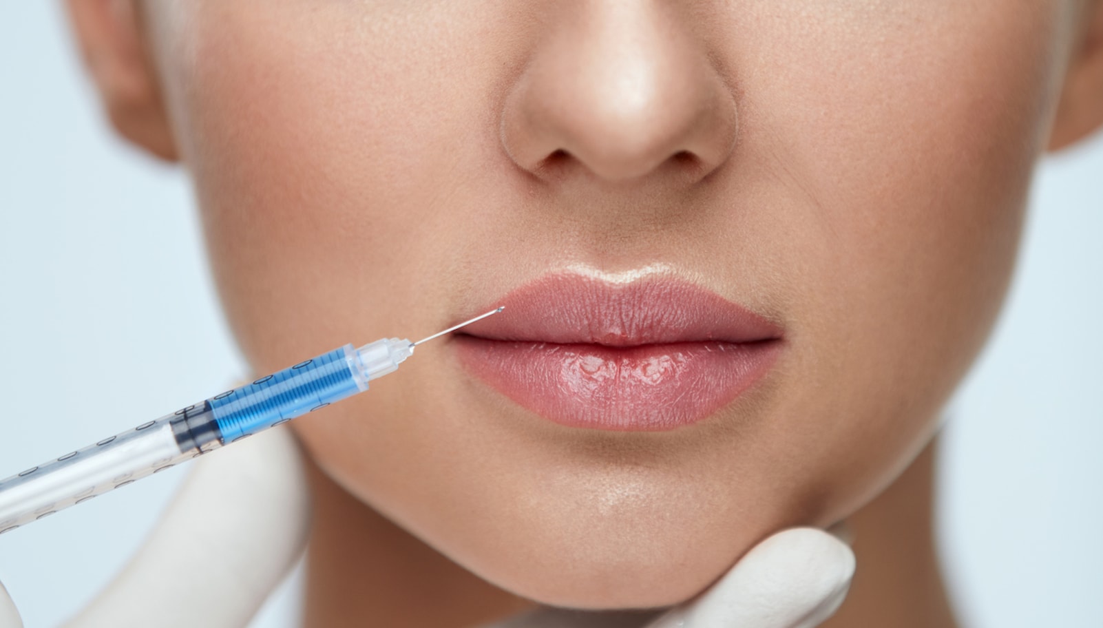 Lip Augmentation in Vietnam: Enhance Volume for Naturally Fuller Lips 3 Lip Augmentation in Vietnam: Enhance Volume for Naturally Fuller Lips